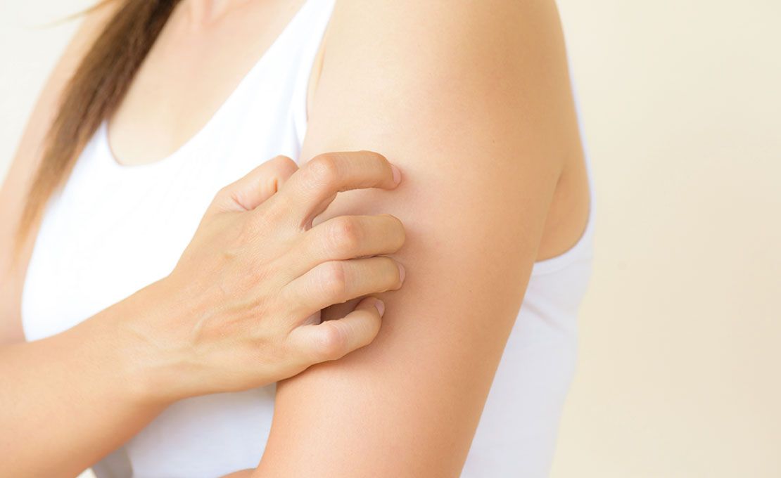 Causes et traitement de l'Eczéma atopique chez l'adulte
