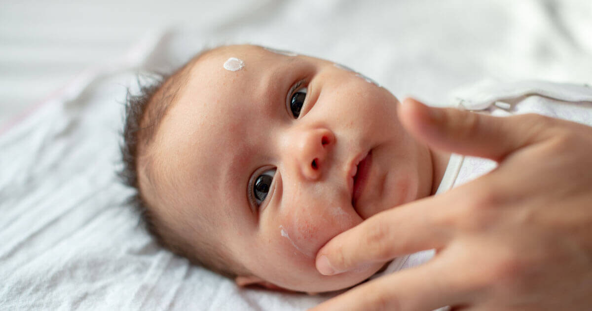 Mon bébé a de l'eczéma, comment le soulager et le traiter?
